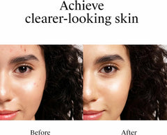 Neutrogena Rapid Clear Stubborn Acne Spot Treatment Gel, Maximum Strength 10% Benzoyl Peroxide Treatment Medication for Acne Prone Skin, Pimple Cream Reduces Size & Redness, 1 oz