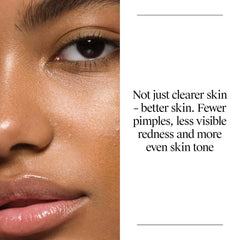 Neutrogena Oil Free Acne Face Wash for Oily Skin, Acne Control Cleanser with Salicylic Acid Noncomedogenic Residue-Free Facial Cleanser in Easy-Pump Bottles, 3 pack of 9.1 fl oz